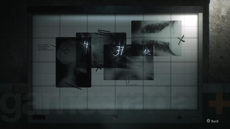 معمای دست Silent Hill 2 Remake: حل قفل ترکیبی و اشعه ایکس