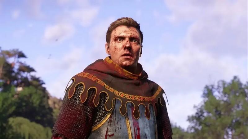 واکنش طرفداران Kingdom Come: Deliverance 2: تصویری از هنری اهل اسکالیتس با چهره ای وحشت زده و غرق در خون در یک دشت در بازی Kingdom Come: Deliverance 2.